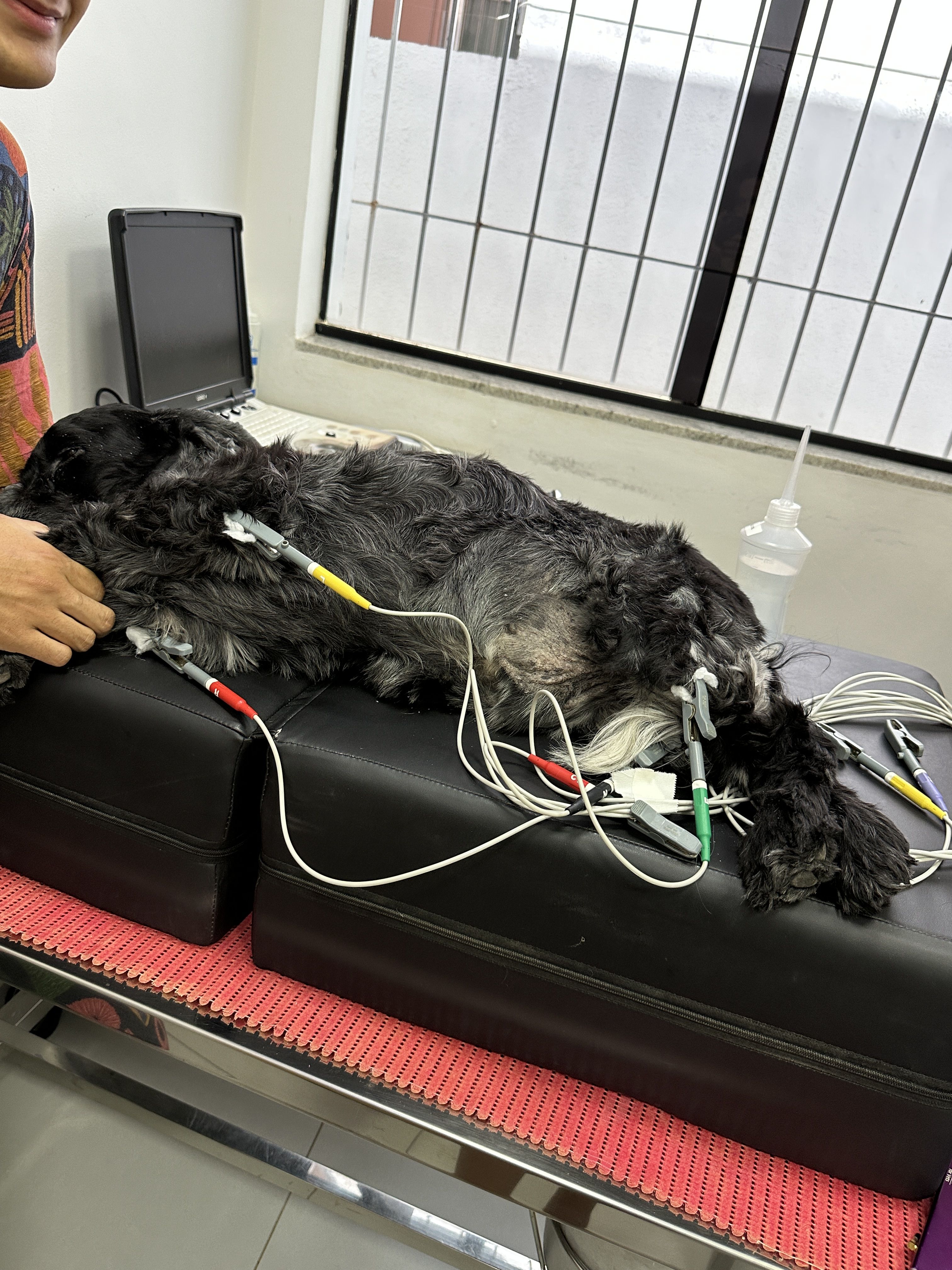 Eletrocardiograma